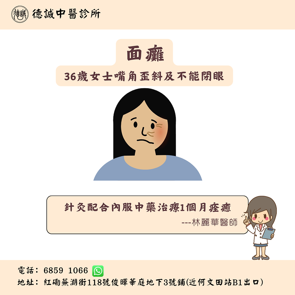 面癱