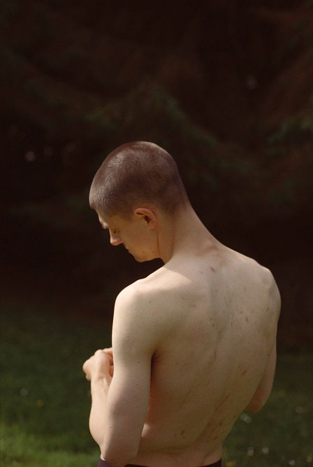 mans hurt nude back with scars and imperfections on expired film looking contemplative and thoughtful