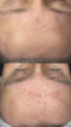 photo-output.jpeg