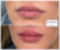 Lips-8 (2).JPEG