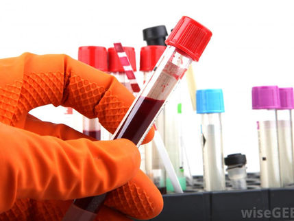 PCR: Amplification of blood extracted DNA.