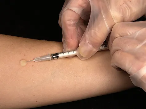 Injection.webp