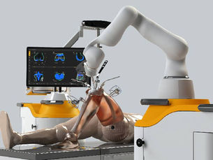 Robotic Joint Replacement: The Future of Precision Orthopedic Surgery