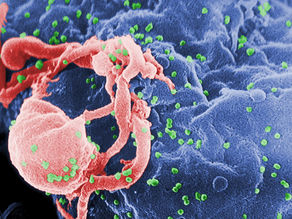 HIV – linhas de pesquisa
