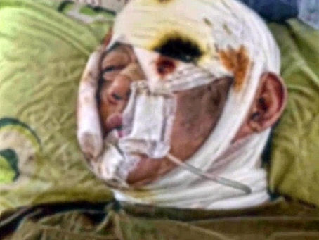 <Korean News> The 'sole survivor' of a North Korean soldier, he hides under a pile of bodies.