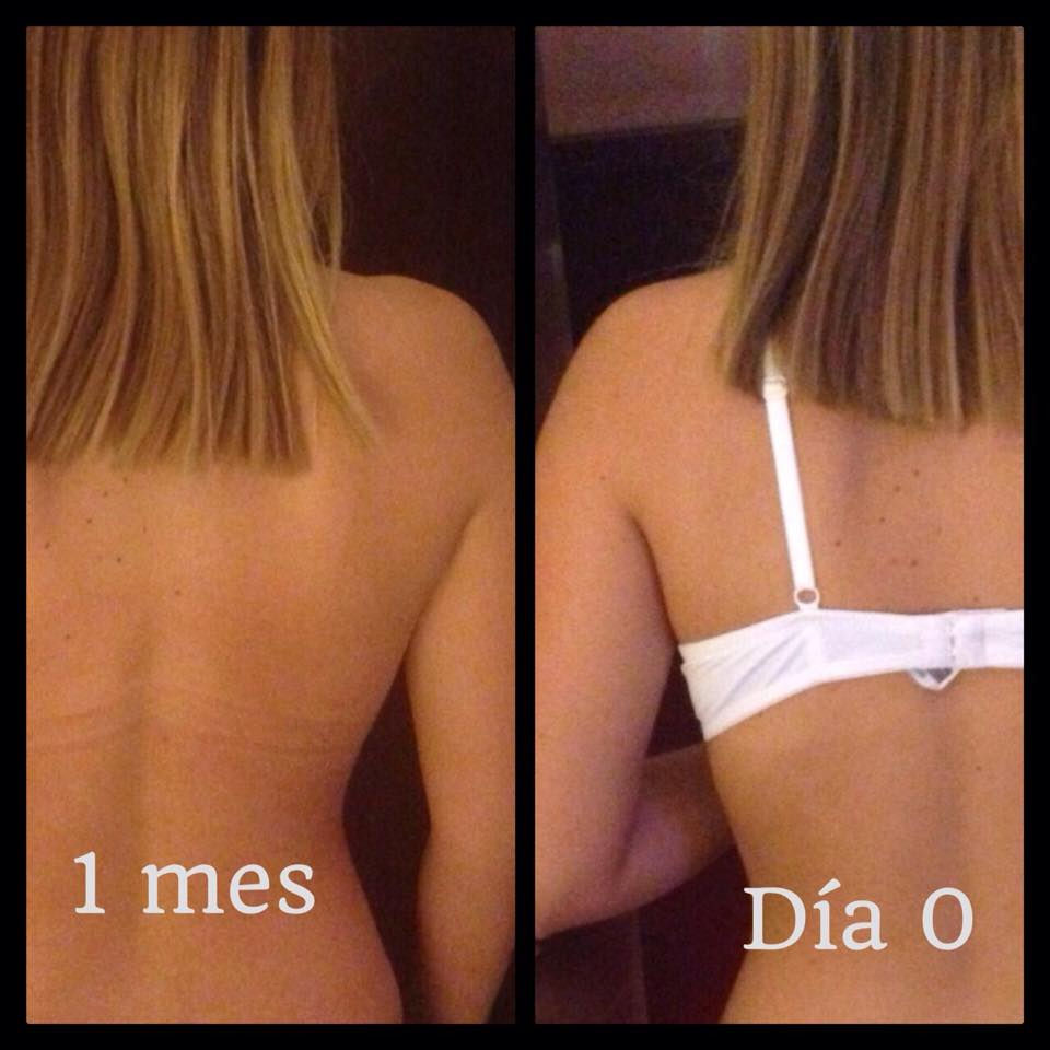 Resultado FASt shampoo