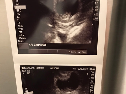 Life Doesn't Slow Down For Pregnant Women, Our First Doctor's Visit (Week 9) Part 1 | Mesha&