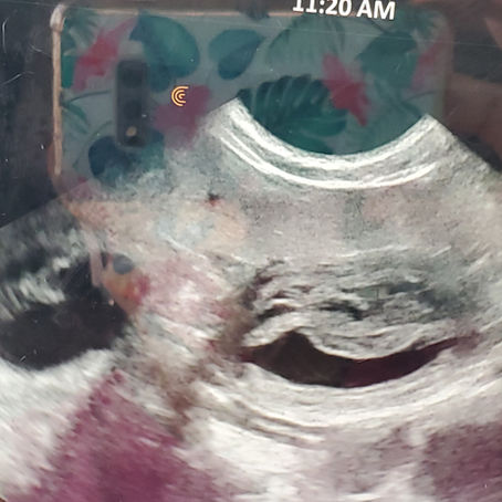 Pregnancy is confirmed!