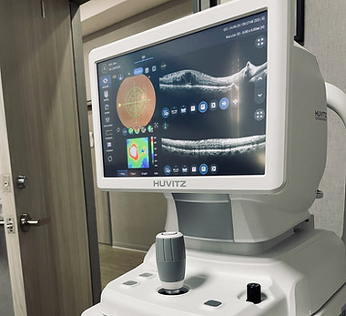 OCT tomografia coherencia optica macular para diagnostico de enfermedades de retina
