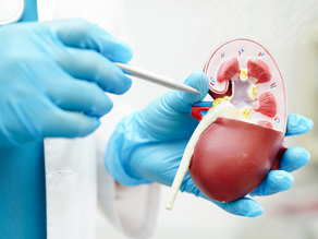 ¿Qué es el cáncer de riñón? Conoce sus Causas, Síntomas y Tratamientos