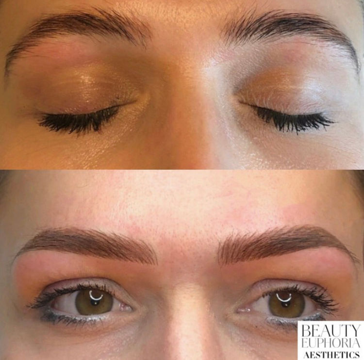 Combination Brows