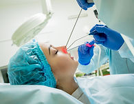 cirugia-endoscopica-seno-vaporizacion-laser-concha-nasal_179755-7561.jpg