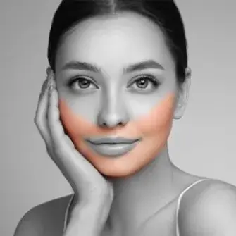 LOWER FACE