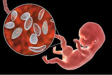 Role of teratogens in congenital anomalies and malformations