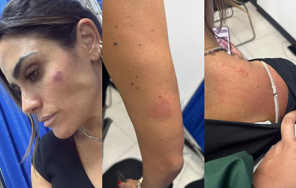 Agreden a alcaldesa Alessandra Rojo y personal de la Cuauhtémoc; señala a gente de Diana Barrios