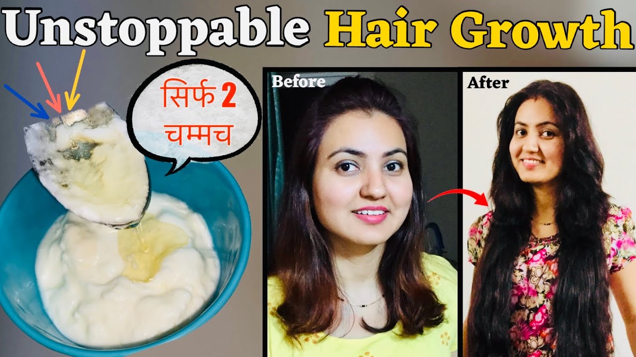 This DIY Hair Tonic to Regrow Lost Hair Preity Prerna
