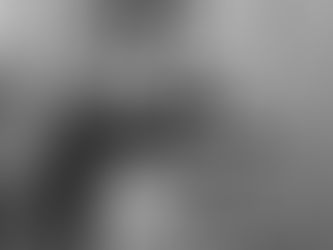 Témoignage réel d’une patiente après cancer gynécologique. Illustration du parcours post-opératoire et de la reconstruction de la sexualité après cancer.