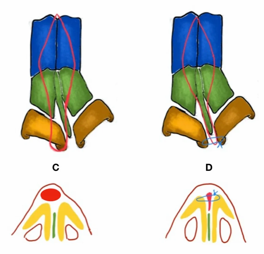 เย็บอินเตอร์โดม