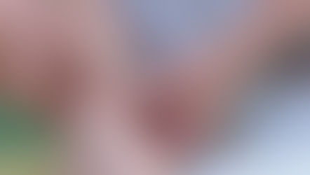 Assessment of lymphatic contractile function following manual lymphatic drainage