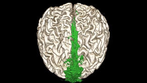A first glimpse of the human brain’s drains