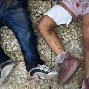 "Was uns die Wunden erzählen" - Internationale Ärztinnen und Ärzte berichten von Gaza