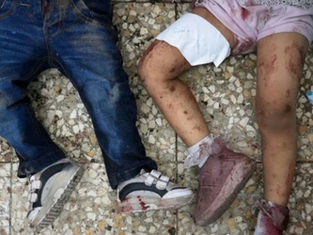 "Was uns die Wunden erzählen" - Internationale Ärztinnen und Ärzte berichten von Gaza