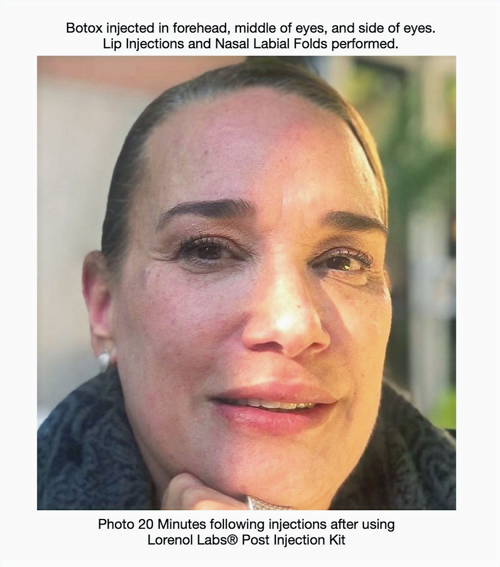 20 Minutes after using the post laser kit 
