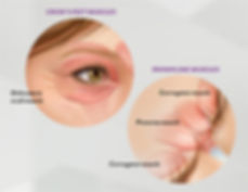 botox injections stamford, ct fairfield county