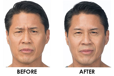 mens skin care stamford ct