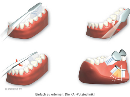 Zahnpflege-Tipps: Welche ist die beste Zahnputz-Technik?