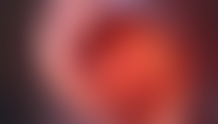 Understanding the Correlation Between Endometriosis and Chronic Pain