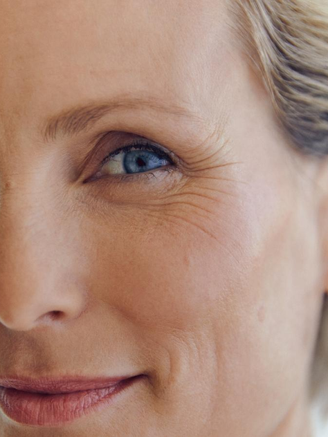 Fine Lines & Wrinkles: What Can You Do About Them?