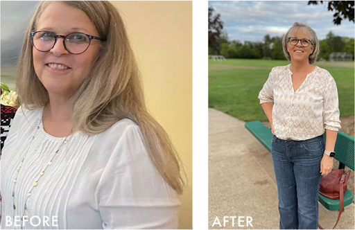 Medical weight loss before & after