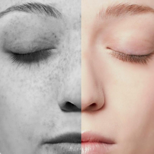 Why Your Sunscreen Might Not Be Working as Well as You Think: Common SPF Mistakes That Lead to Sun Damage