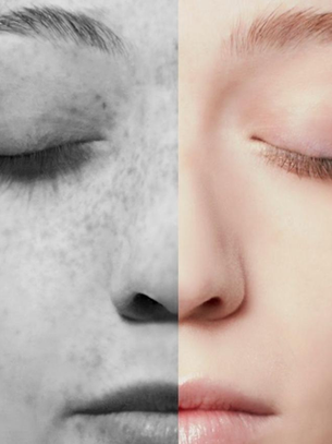 Why Your Sunscreen Might Not Be Working as Well as You Think: Common SPF Mistakes That Lead to Sun Damage
