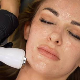 Triple MCH Glow Peel & Facial: The Glow That Doesn't Quit After You Wash Your Face