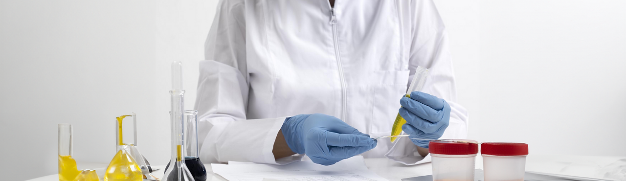 Urinalysis.png