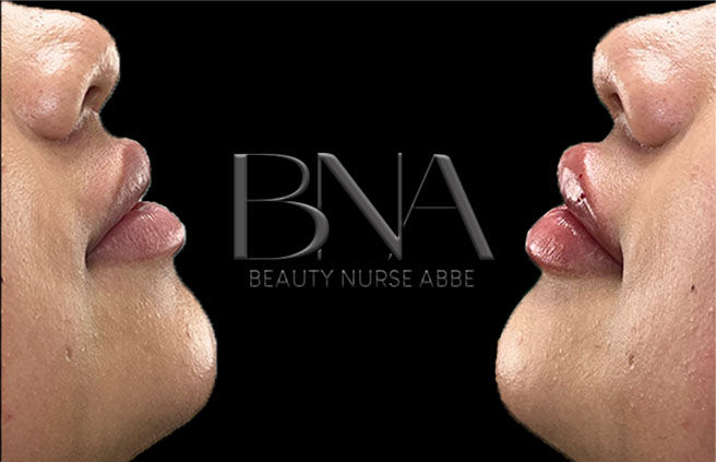 Beauty Nurse Abbe