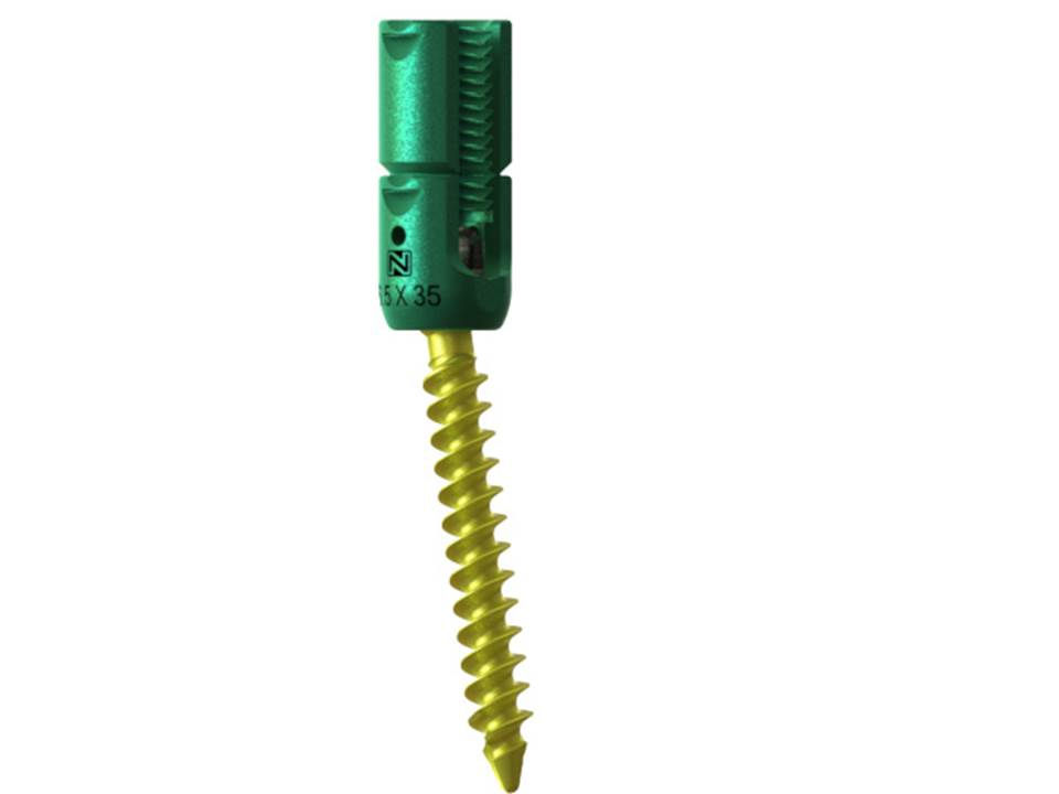 Inertia® Reduction Pedicle Screw