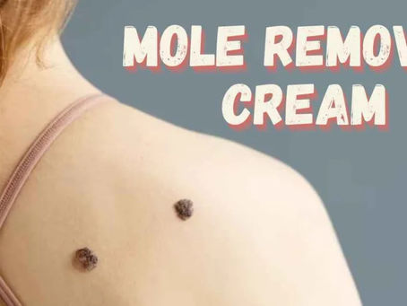 How to Choose the Best Mole Removal Cream