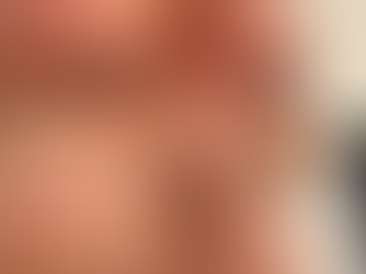 夏のダメージ【シミや酸化の原因メラニン排除】は9月が勝負🆚