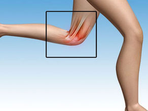 Tendinite da Pata de Ganso