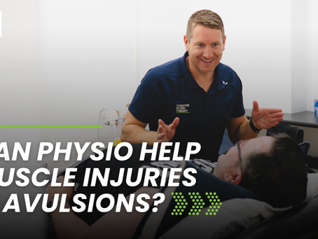 Can Physio Help Muscle Injuries — Avulsions?