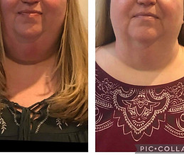 Double-Chin-4-slimming-1-toning.jpg