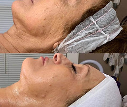 3-facials-treatments.jpg