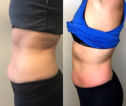 10 slimming.JPG