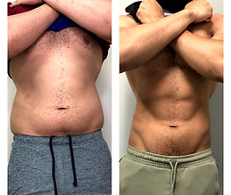 19-slimming-over-1-year-_thrivecryostudio.jpg