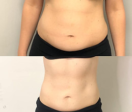 2-slimming-treatments-2-1.jpg