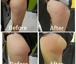 1-toning-treatment.jpg