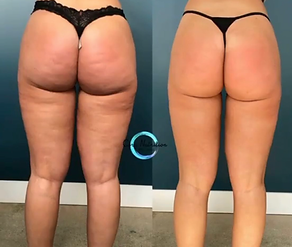9 treatments (give credit to Core Nutrition _ Wellness)